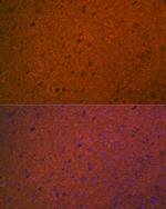 Syntaxin 1 Antibody in Immunohistochemistry (Paraffin) (IHC (P))