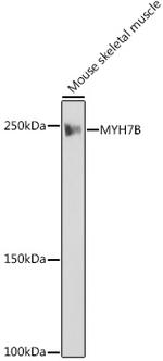 MYH7B Antibody in Western Blot (WB)