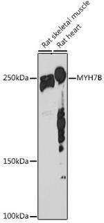 MYH7B Antibody in Western Blot (WB)