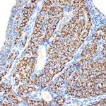 HSD3B1 Antibody in Immunohistochemistry (Paraffin) (IHC (P))