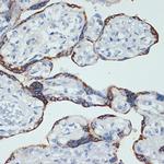 HSD3B1 Antibody in Immunohistochemistry (Paraffin) (IHC (P))