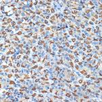 ATP4B Antibody in Immunohistochemistry (Paraffin) (IHC (P))