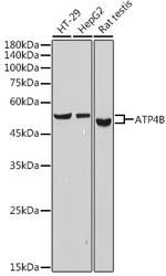 ATP4B Antibody in Western Blot (WB)