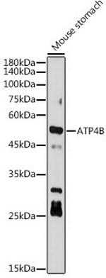 ATP4B Antibody in Western Blot (WB)