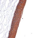 Cytokeratin 12 Antibody in Immunohistochemistry (Paraffin) (IHC (P))