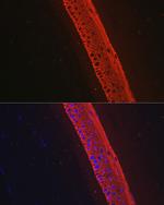 Cytokeratin 12 Antibody in Immunohistochemistry (Paraffin) (IHC (P))