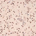 EHMT2 Antibody in Immunohistochemistry (Paraffin) (IHC (P))