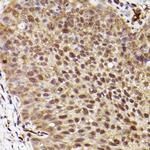 ERK1 Antibody in Immunohistochemistry (Paraffin) (IHC (P))