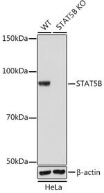 STAT5 beta Antibody in Western Blot (WB)