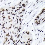 ARID1A Antibody in Immunohistochemistry (Paraffin) (IHC (P))