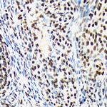 ARID1A Antibody in Immunohistochemistry (Paraffin) (IHC (P))