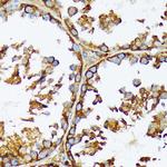 Acetyl-CoA Carboxylase Antibody in Immunohistochemistry (Paraffin) (IHC (P))