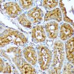 Acetyl-CoA Carboxylase Antibody in Immunohistochemistry (Paraffin) (IHC (P))