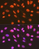 ENT2 Antibody in Immunocytochemistry (ICC/IF)