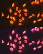 ENT2 Antibody in Immunocytochemistry (ICC/IF)