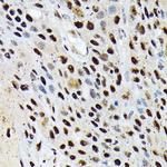 ENT2 Antibody in Immunohistochemistry (Paraffin) (IHC (P))