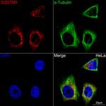 SQSTM1 Antibody in Immunocytochemistry (ICC/IF)