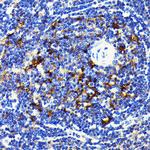 SQSTM1 Antibody in Immunohistochemistry (Paraffin) (IHC (P))