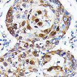 SQSTM1 Antibody in Immunohistochemistry (Paraffin) (IHC (P))