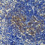 SQSTM1 Antibody in Immunohistochemistry (Paraffin) (IHC (P))