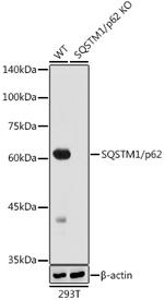 SQSTM1 Antibody