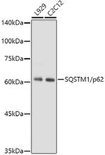 SQSTM1 Antibody in Western Blot (WB)