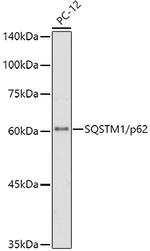 SQSTM1 Antibody in Western Blot (WB)