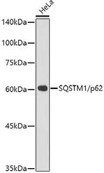 SQSTM1 Antibody in Western Blot (WB)