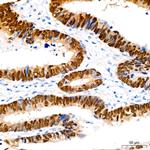 SOX9 Antibody in Immunohistochemistry (Paraffin) (IHC (P))