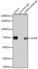 SOX9 Antibody in Immunoprecipitation (IP)