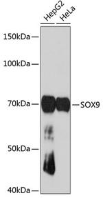 SOX9 Antibody in Western Blot (WB)