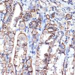 VPS11 Antibody in Immunohistochemistry (Paraffin) (IHC (P))