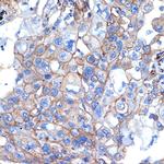 Talin 2 Antibody in Immunohistochemistry (Paraffin) (IHC (P))