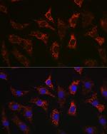 BAX Antibody in Immunocytochemistry (ICC/IF)