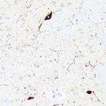 Somatostatin Antibody in Immunohistochemistry (Paraffin) (IHC (P))