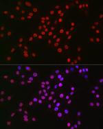 MCM2 Antibody in Immunocytochemistry (ICC/IF)