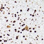 MCM2 Antibody in Immunohistochemistry (Paraffin) (IHC (P))