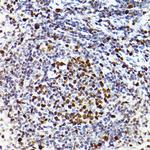 MCM2 Antibody in Immunohistochemistry (Paraffin) (IHC (P))