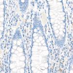 MRP1 Antibody in Immunohistochemistry (Paraffin) (IHC (P))