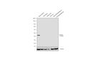 Podocin Antibody in Western Blot (WB)