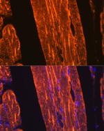 ACTA1 Antibody in Immunohistochemistry (Paraffin) (IHC (P))