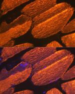 ACTA1 Antibody in Immunohistochemistry (Paraffin) (IHC (P))