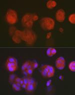 RCL Antibody in Immunocytochemistry (ICC/IF)