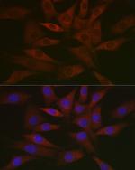 RCL Antibody in Immunocytochemistry (ICC/IF)