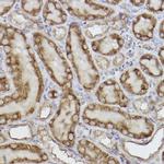 Adenylate Kinase 4 Antibody in Immunohistochemistry (Paraffin) (IHC (P))