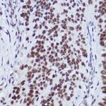 USP39 Antibody in Immunohistochemistry (Paraffin) (IHC (P))