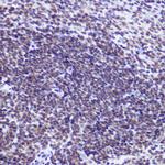 USP39 Antibody in Immunohistochemistry (Paraffin) (IHC (P))