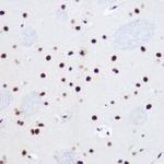 USP39 Antibody in Immunohistochemistry (Paraffin) (IHC (P))