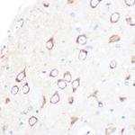 CD204 Antibody in Immunohistochemistry (Paraffin) (IHC (P))