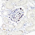 WT1 Antibody in Immunohistochemistry (Paraffin) (IHC (P))